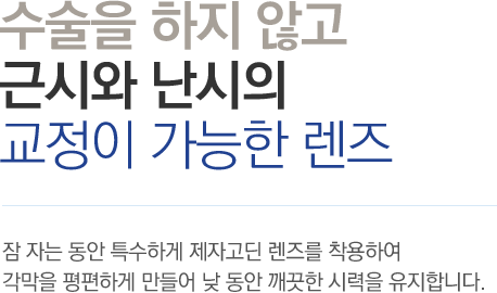 수술을 하지 않고 근시와 난시의 교정이 가능한 렌즈 - 잠 자는 동안 특수하게 제자고딘 렌즈를 착용하여 각막을 평편하게 만들어 낮 동안 깨끗한 시력을 유지합니다.