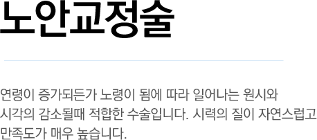 노안교정술 - 연령이 증가되든가 노령이 됨에 따라 일어나는 원시와 시각의 감소될때 적합한 수술입니다. 시력의 질이 자연스럽고 만족도가 매우 높습니다. 